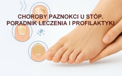 Choroby paznokci u stóp – poradnik leczenia i profilaktyki