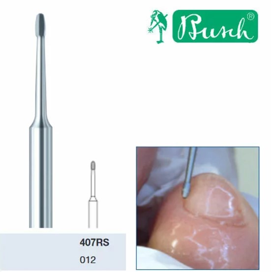 Stopa cukrzycowa w gabinecie podologicznym Część I only clean